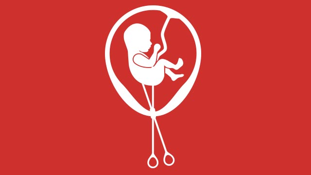 Aborto considerado como “morte natural”